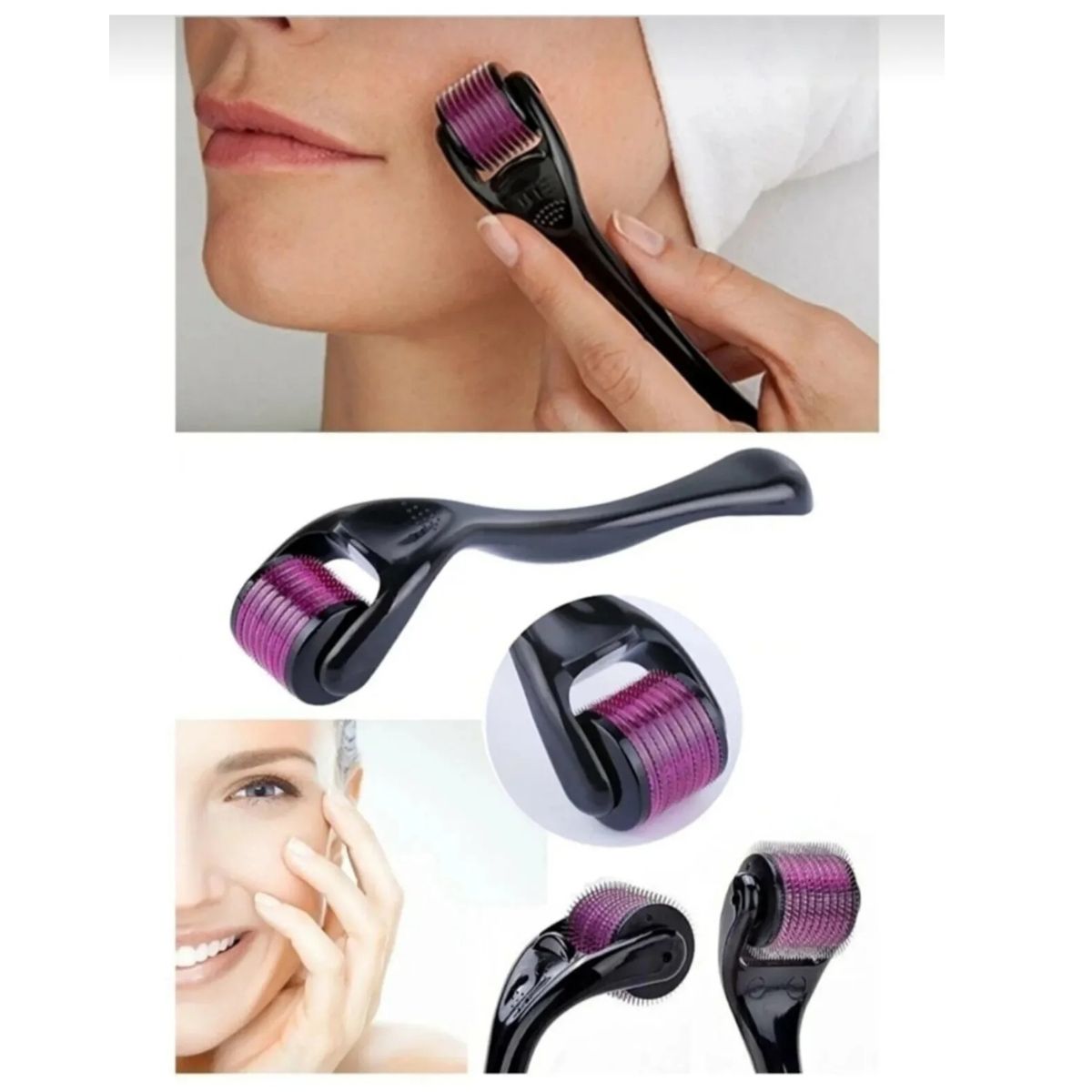 Dermaroller System Rolo 540 Microagulhas Esfoliador Pele
